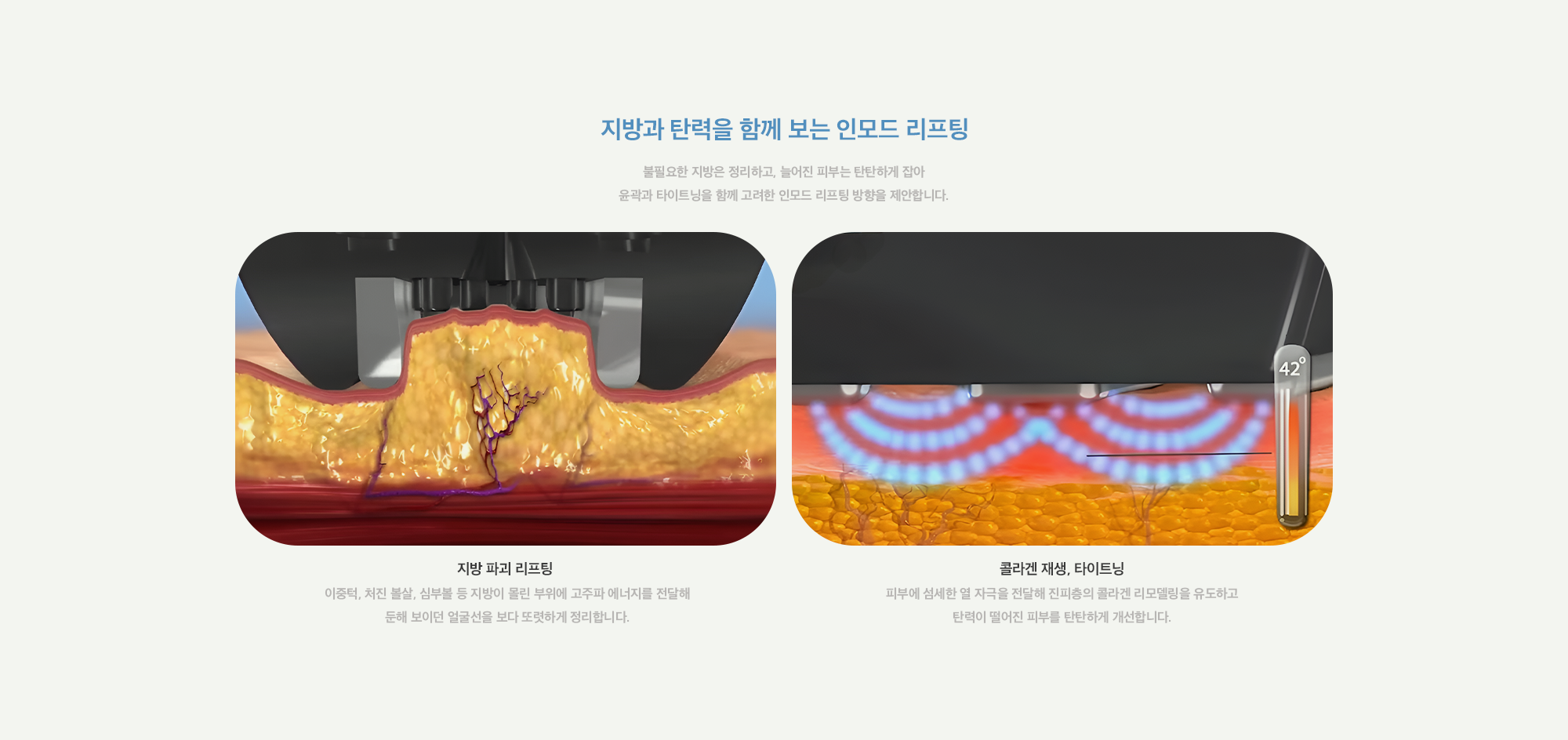 [지방과 탄력을 함께 보는 인모드 리프팅] 지방 파괴 리프팅 : 이중턱, 처진 볼살, 심부볼 등 지방이 몰린 부위에 고주파 에너지를 전달해 둔해 보이던 얼굴선을 보다 또렷하게 정리합니다. / 콜라겐 재생, 타이트닝 : 피부에 섬세한 열 자극을 전달해 진피층의 콜라겐 리모델링을 유도하고 탄력이 떨어진 피부를 탄탄하게 개선합니다.