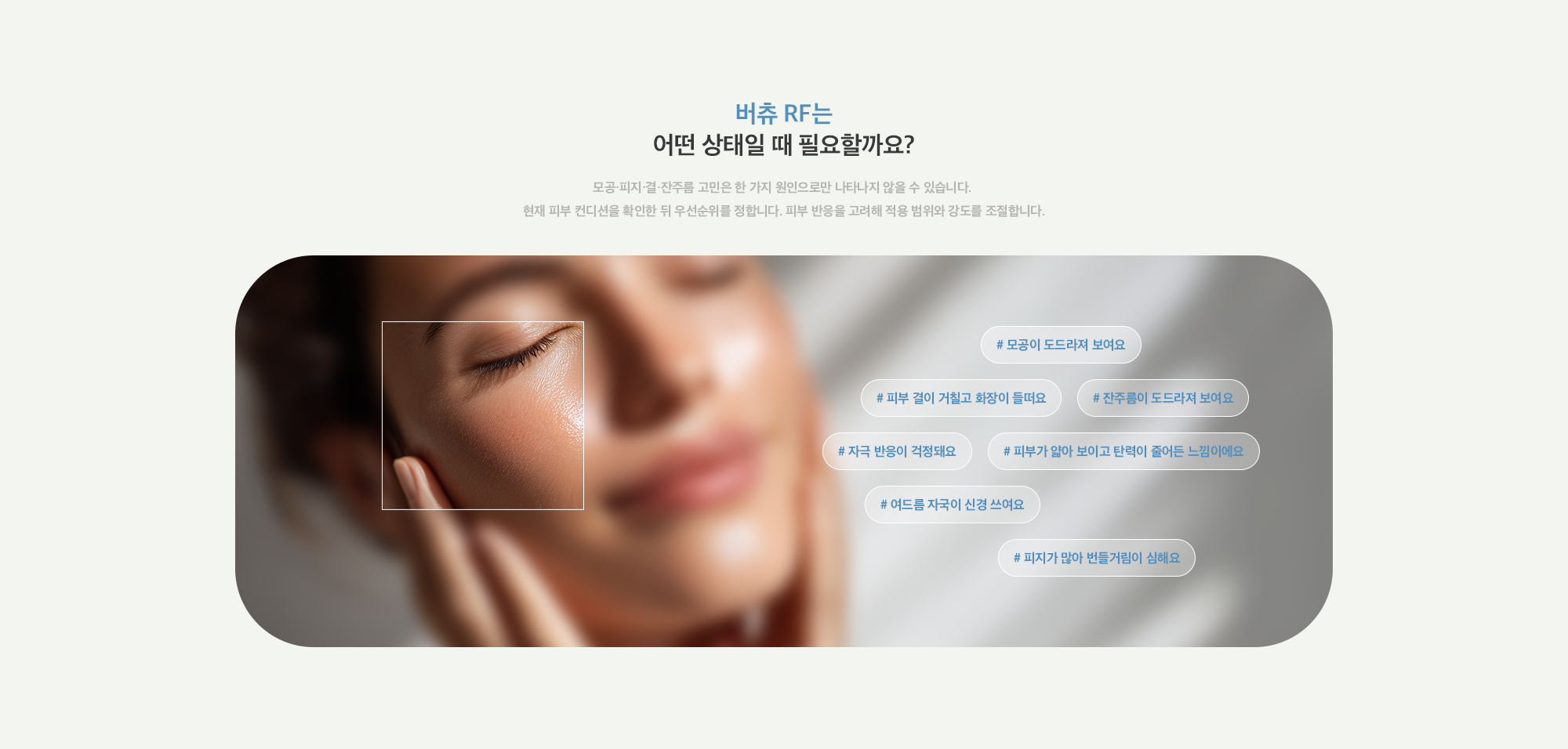 [버츄 RF는 어떤 상태일 때 필요할까요?] # 모공이 도드라져 보여요 # 잔주름이 도드라져 보여요 # 피부 결이 거칠고 화장이 들떠요 # 자극 반응이 걱정돼요 # 피부가 얇아 보이고 탄력이 줄어든 느낌이에요 # 여드름 자국이 신경 쓰여요 # 피지가 많아 번들거림이 심해요