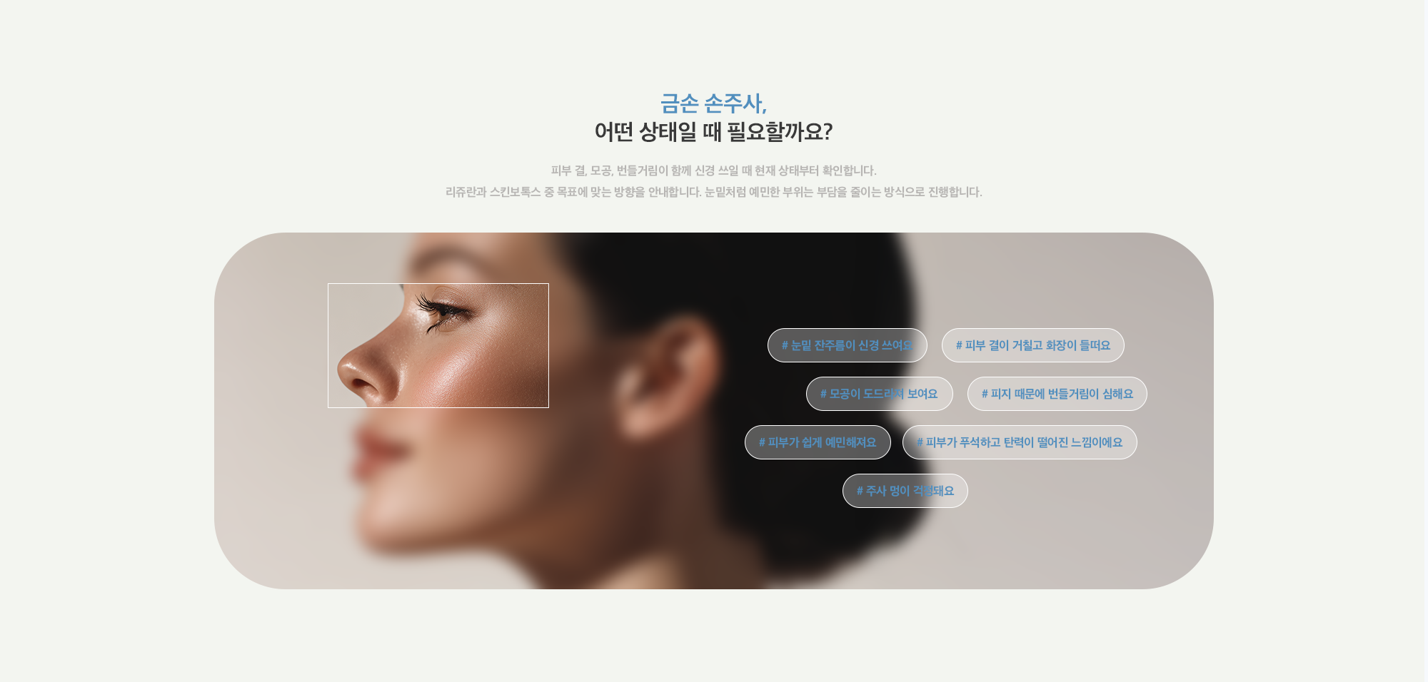 [금손 손주사, 어떤 상태일 때 필요할까요?] # 눈밑 잔주름이 신경 쓰여요 # 피부 결이 거칠고 화장이 들떠요 # 모공이 도드라져 보여요 # 피지 때문에 번들거림이 심해요 # 피부가 쉽게 예민해져요 # 피부가 푸석하고 탄력이 떨어진 느낌이에요 # 주사 멍이 걱정돼요