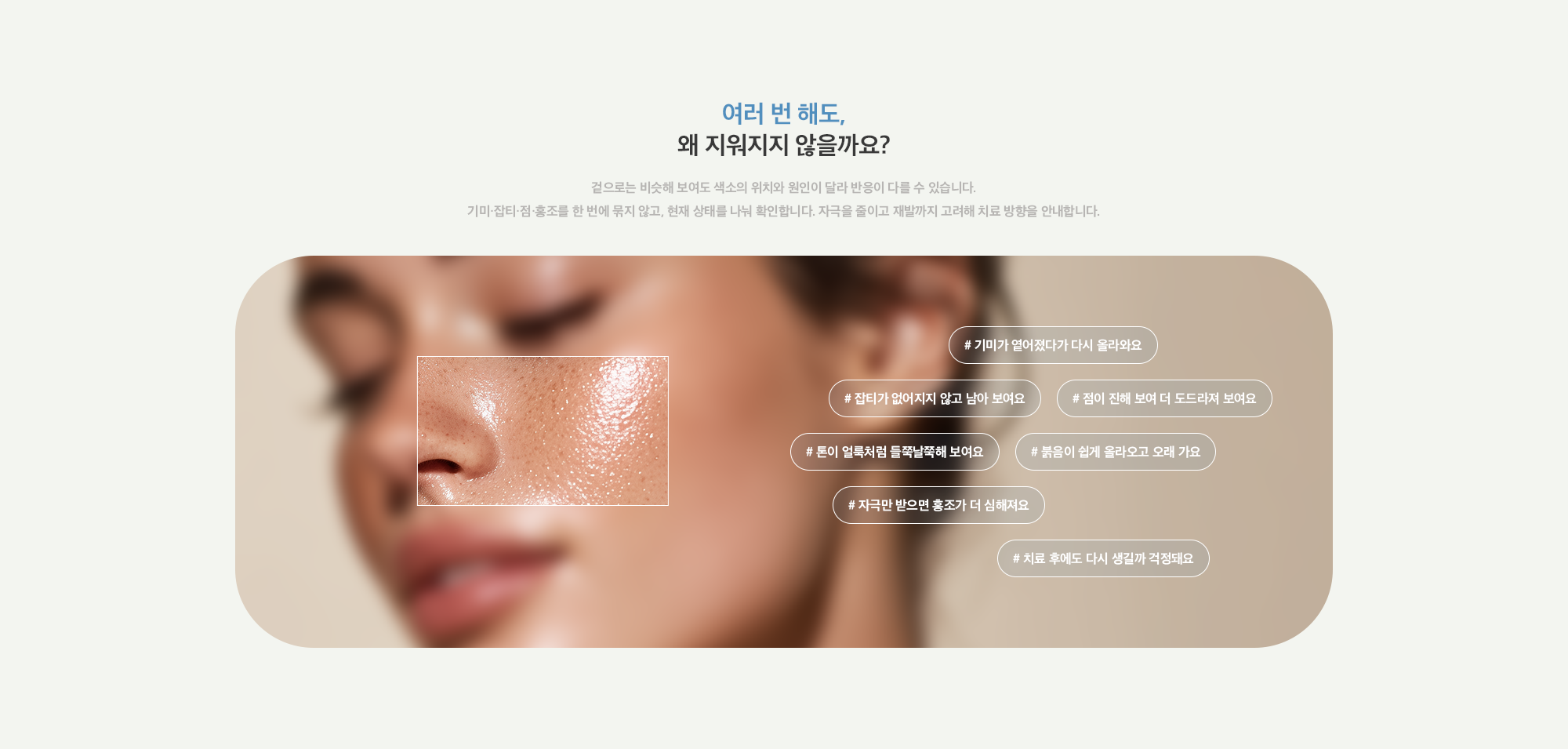 [여러 번 해도, 왜 지워지지 않을까요?] # 기미가 옅어졌다가 다시 올라와요 # 잡티가 없어지지 않고 남아 보여요 # 점이 진해 보여 더 도드라져 보여요 # 톤이 얼룩처럼 들쭉날쭉해 보여요 # 붉음이 쉽게 올라오고 오래 가요 # 자극만 받으면 홍조가 더 심해져요 # 치료 후에도 다시 생길까 걱정돼요