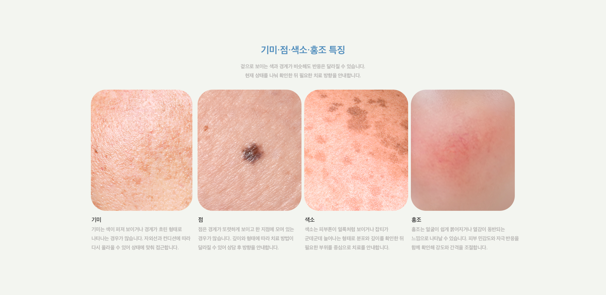 [기미·점·색소·홍조 특징] 기미 : 기미는 색이 퍼져 보이거나 경계가 흐린 형태로 나타나는 경우가 많으며 자외선과 컨디션에 따라 재발할 수 있어 상태에 맞춰 접근합니다. / 점 : 점은 경계가 또렷하게 보이고 한 지점에 모여 있는 경우가 많으며 깊이와 형태에 따라 치료 방법이 달라집니다. / 색소 : 색소는 피부톤이 얼룩처럼 보이거나 잡티가 군데군데 늘어나는 형태로 분포와 깊이를 확인한 뒤 필요한 부위를 중심으로 치료를 안내합니다. / 홍조 : 홍조는 얼굴이 쉽게 붉어지거나 열감이 동반되는 느낌으로 나며 피부 민감도와 자극 반응을 함께 확인해 강도와 간격을 조절합니다.